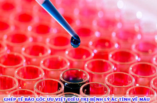 Ghép tế bào gốc ưu việt điều trị bệnh lý ác tính về máu